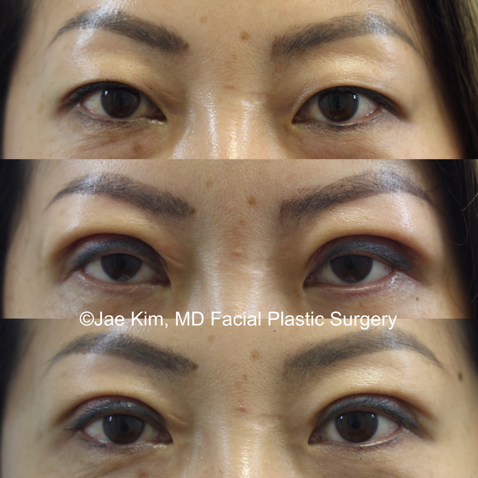 Facelift Paramus