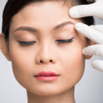 recovery after Asian eyelid surgery