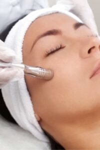 Microdermabrasion virginia