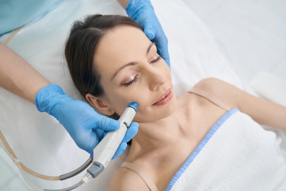 How Much Does Microneedling Cost in Fairfax