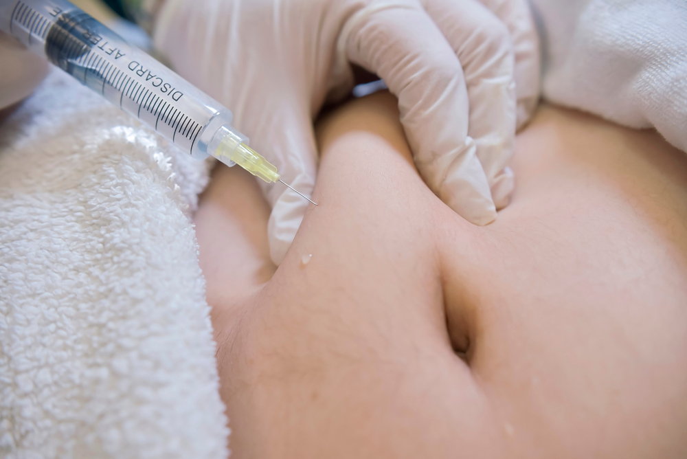 How Much Are Lipo C Injections in Virginia?