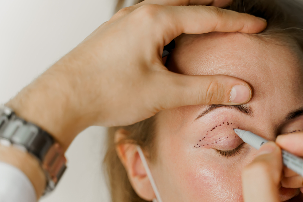 Here’s How to Find the Best Eyelid Surgeon in Northern Virginia