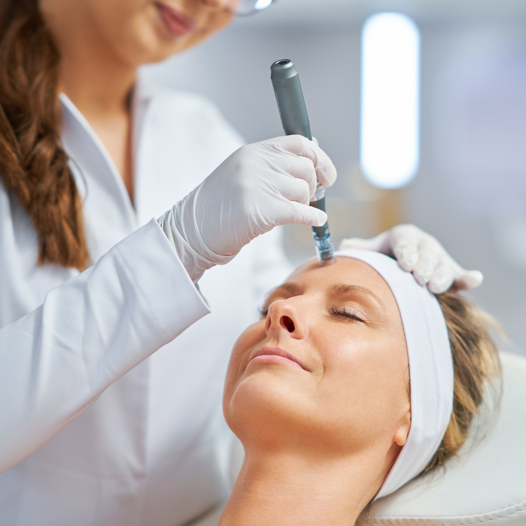 Microneedling Cost in Fairfax Virginia