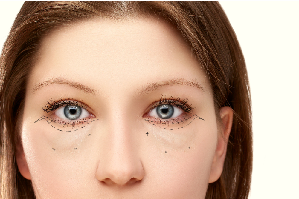 Eyelid Surgery Consultation Availability in Arlington, Virginia