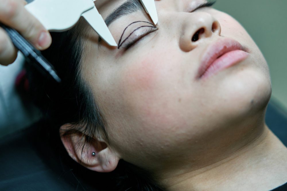 Best Surgeon for Asian Eyelid Surgery in Washington, DC