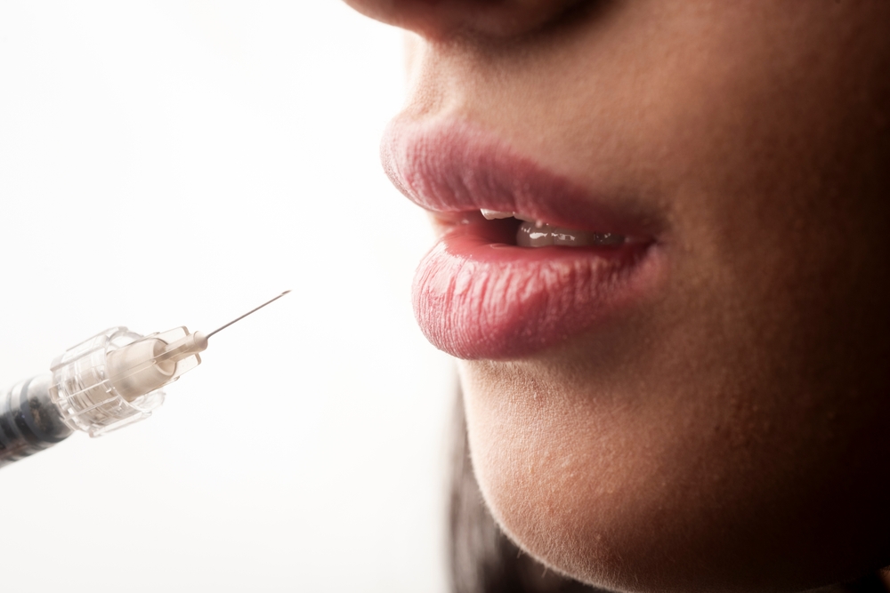What You Need to Know Before Booking Lip Fillers in Arlington or Tysons