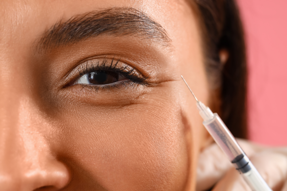 Botox for Crow’s Feet Treatment Near Arlington, VA