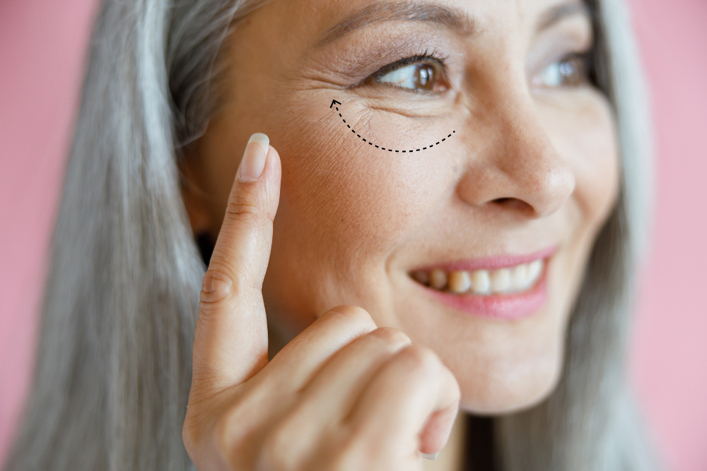 Affordable Eyelid Surgery Pricing in McLean, VA