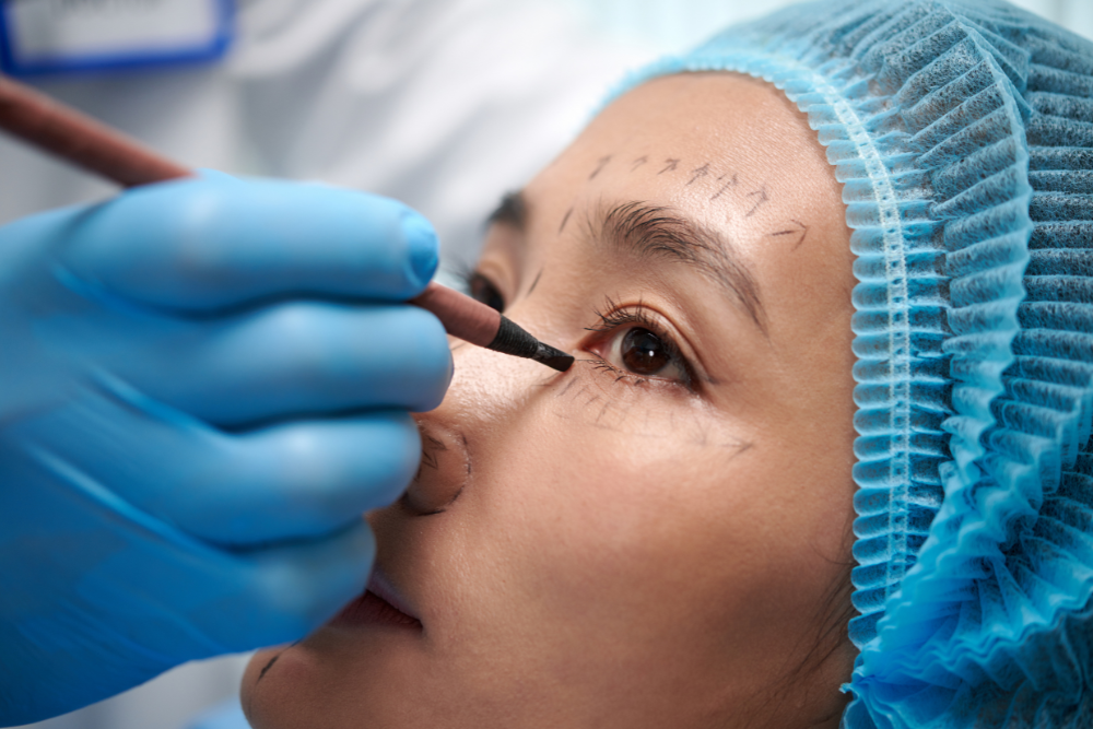 Top Surgeons for Revision Eyelid Surgery in Alexandria, VA