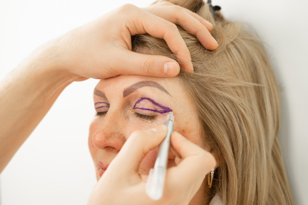 Best Revision Eyelid Surgery Consultations in Fairfax, VA