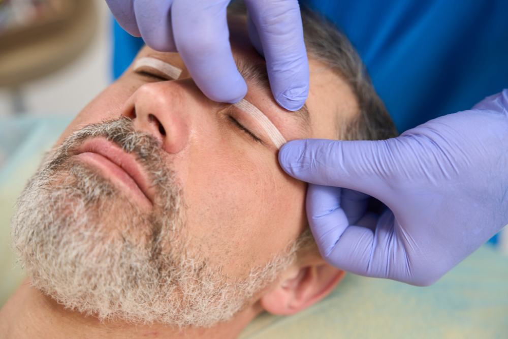 Upper Eyelid Surgery for Hooded Eyelids in Alexandria, VA