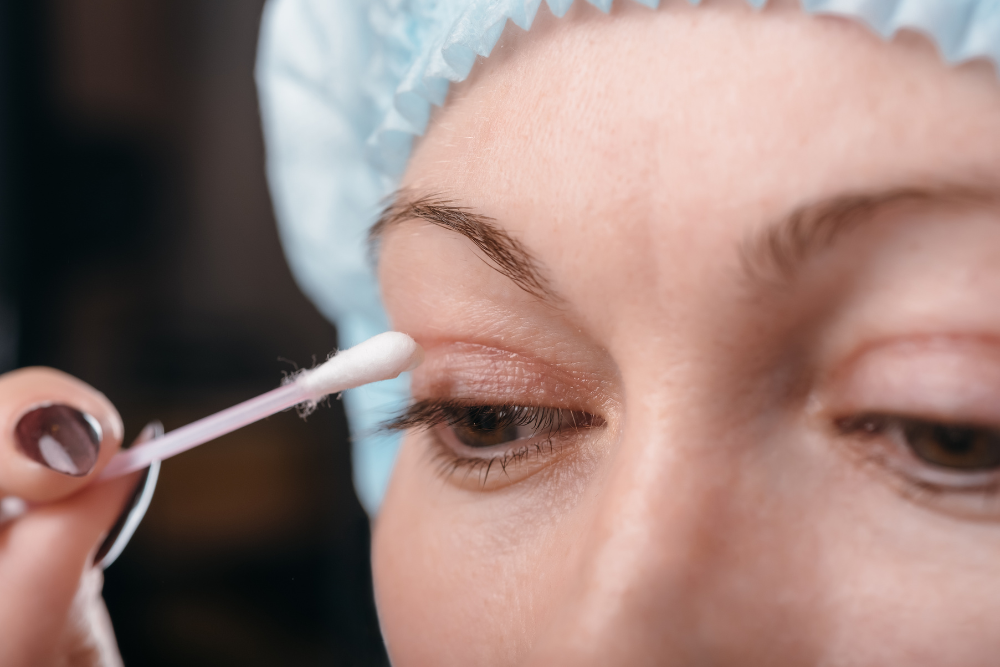 Recovering From Eyelid Surgery in Fairfax, Virginia