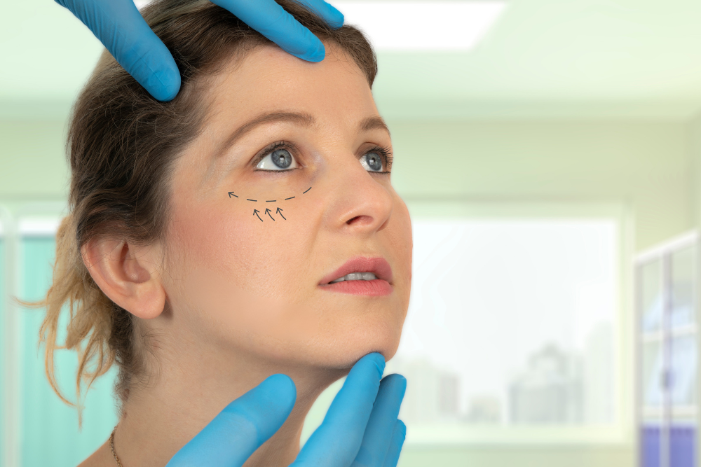 Cost and Consultation for Eyelid Surgery in Reston, Virginia