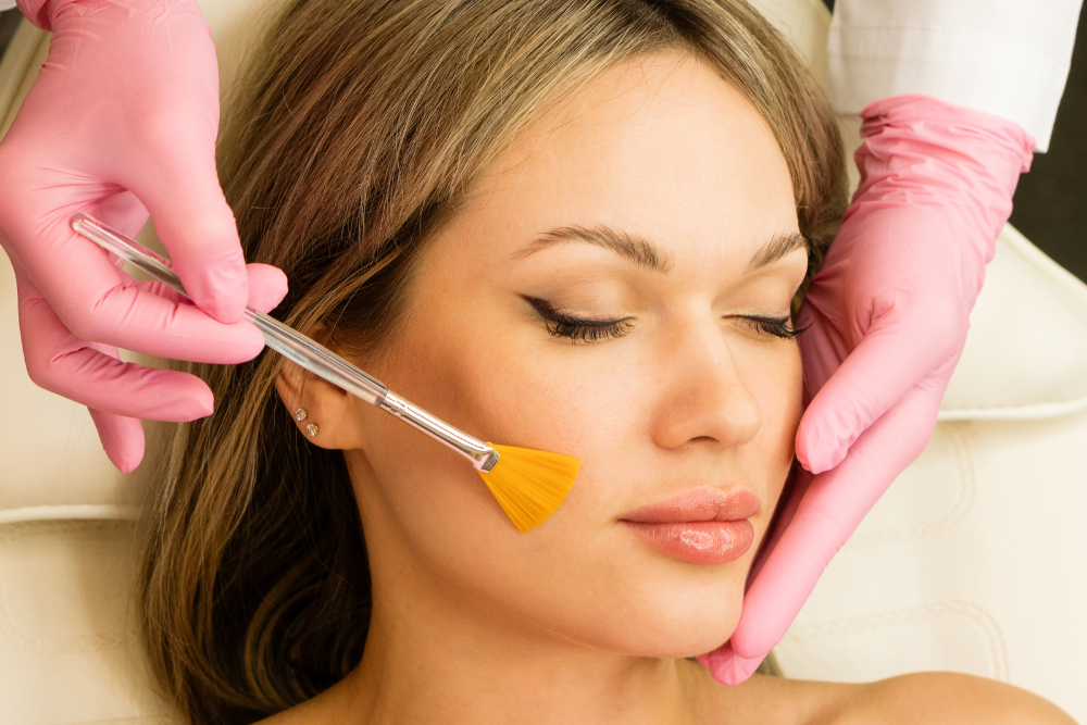 Medium vs. Deep Chemical Peel Pricing in Reston, VA