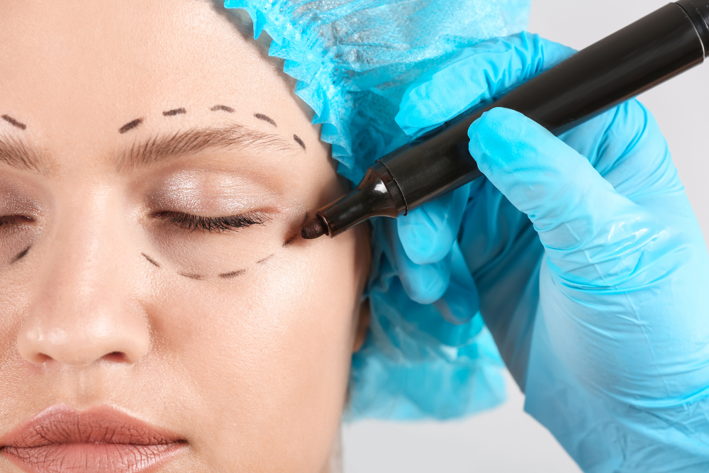 Eyelid Surgery Guide in Washington, DC
