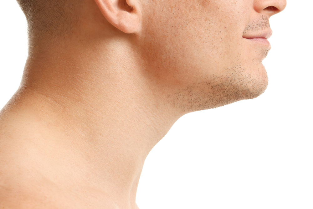 Jawline Filler in Fairfax, VA