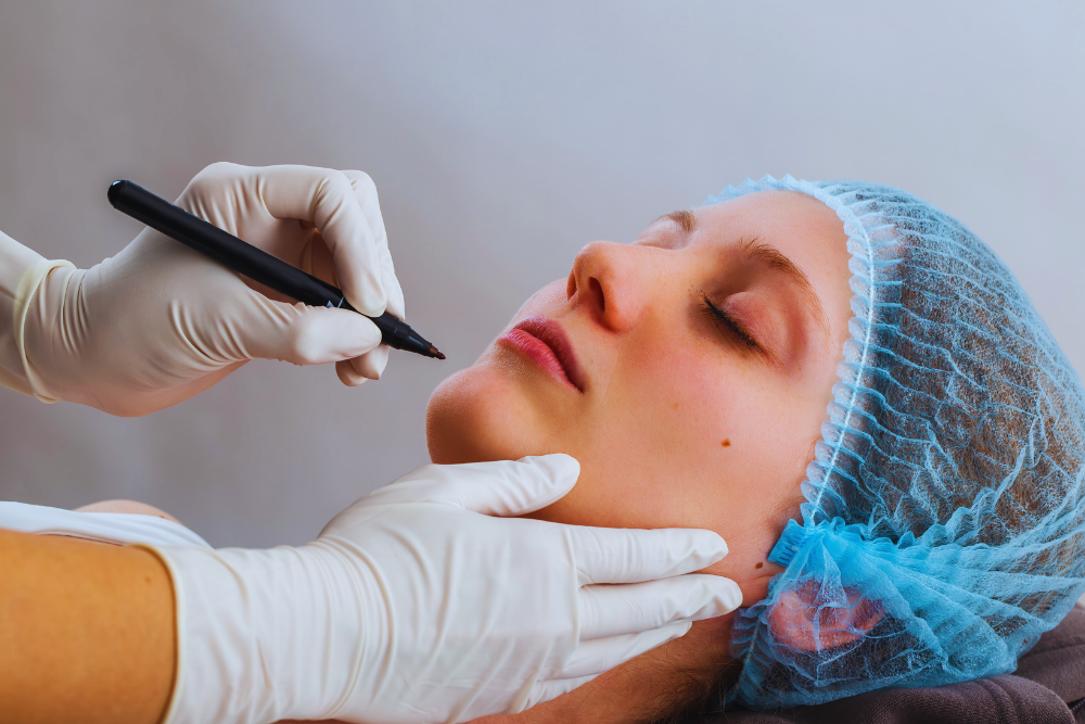 Best Chin Implant Surgeon in Norfolk VA