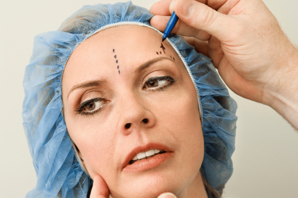 Upper Eyelid Surgery Consultation in McLean Virginia