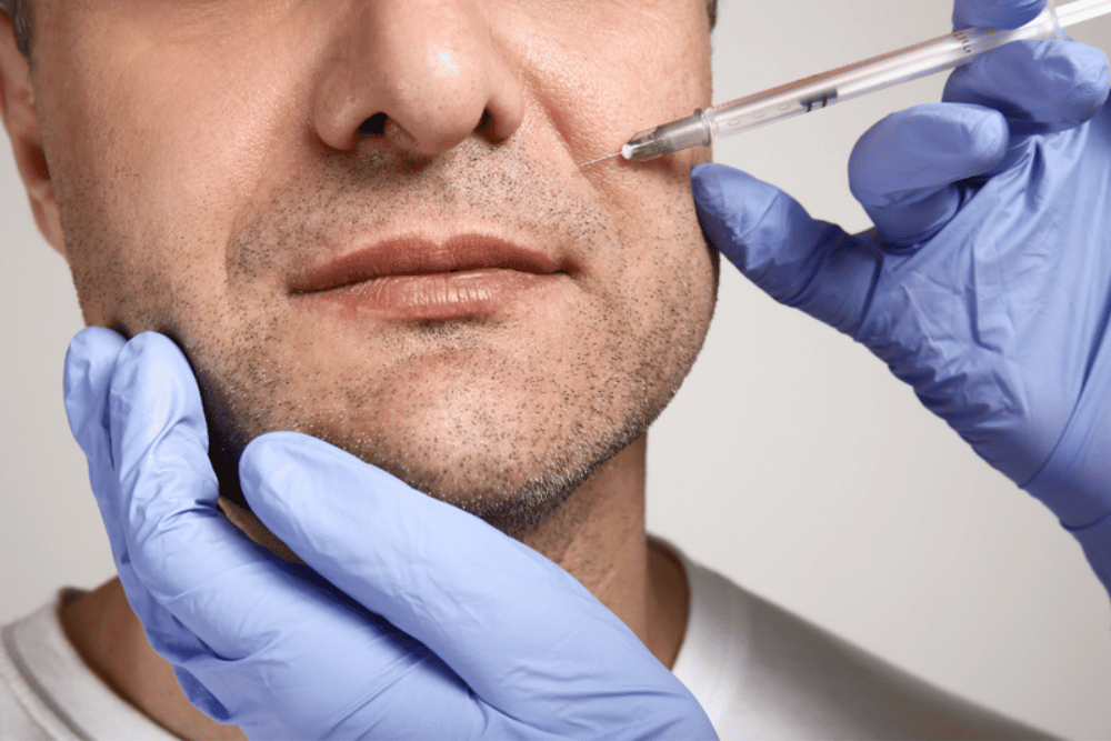 Best Dermal Filler Treatments for Wrinkles in Reston Virginia
