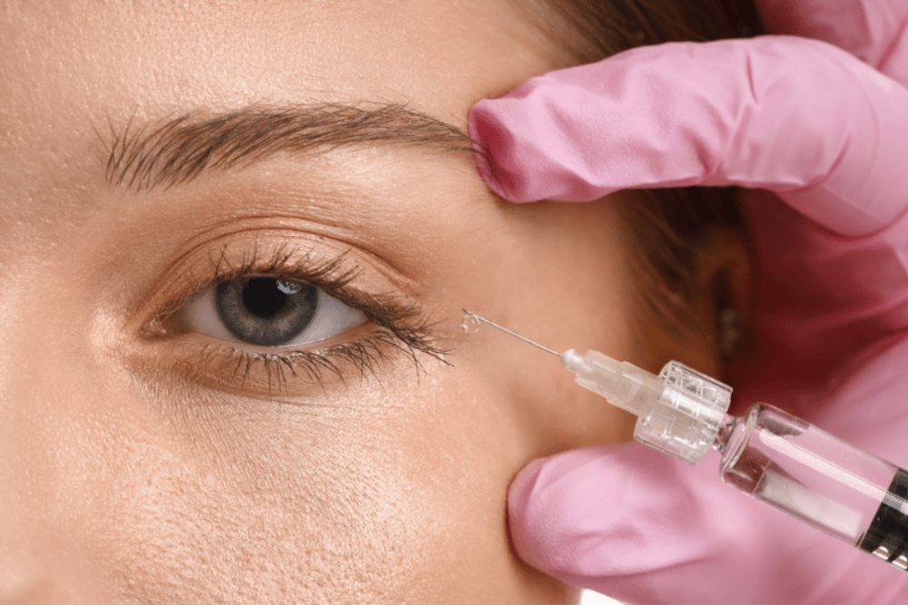 Botox Treatments for Crow's Feet in McLean Virginia