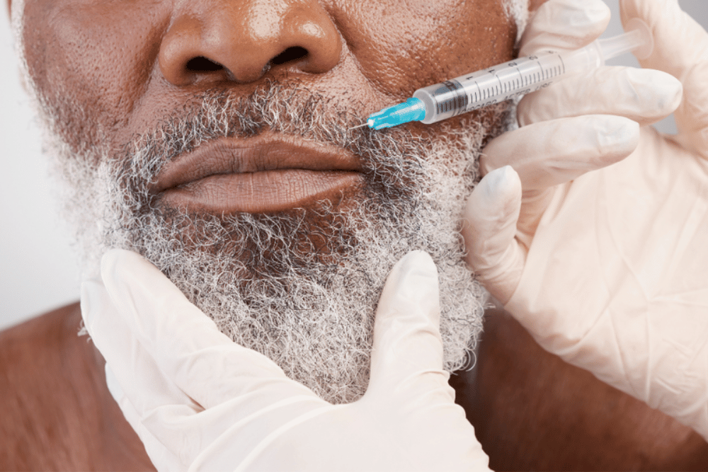 Lip Filler Injections Near Vienna Virginia