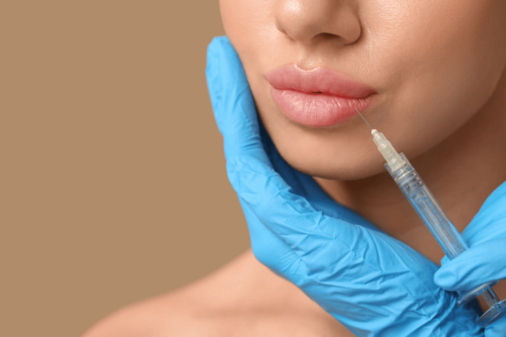 Lip Filler Consultations in Fairfax VA