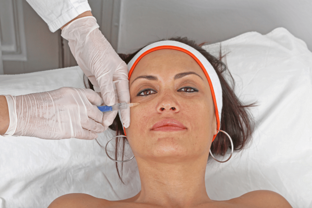 Best Under Eye Filler for Tear Trough Correction Near Alexandria Virginia