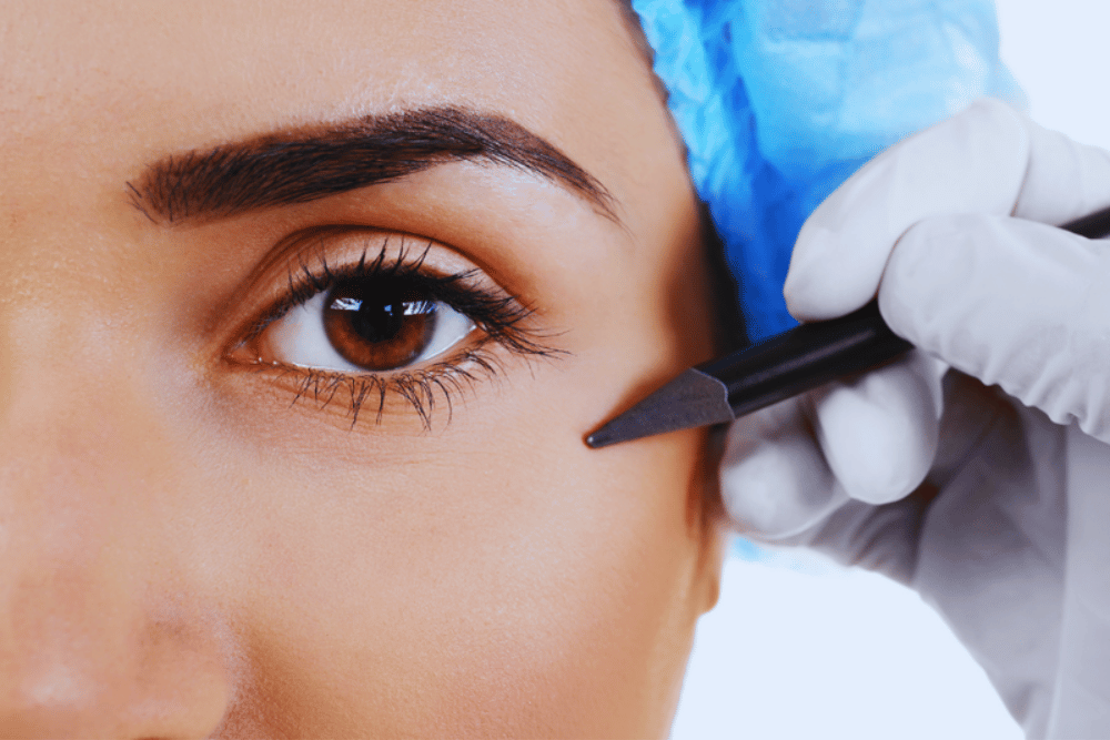 Upper and Lower Eyelid Surgery Near Reston Virginia