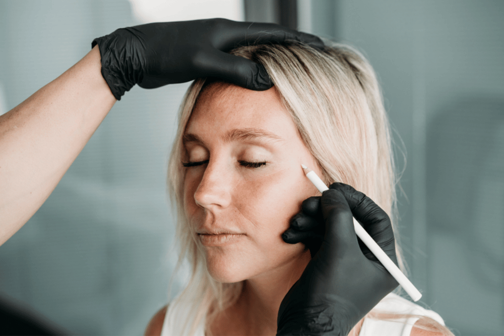 Natural Blepharoplasty in Tysons VA