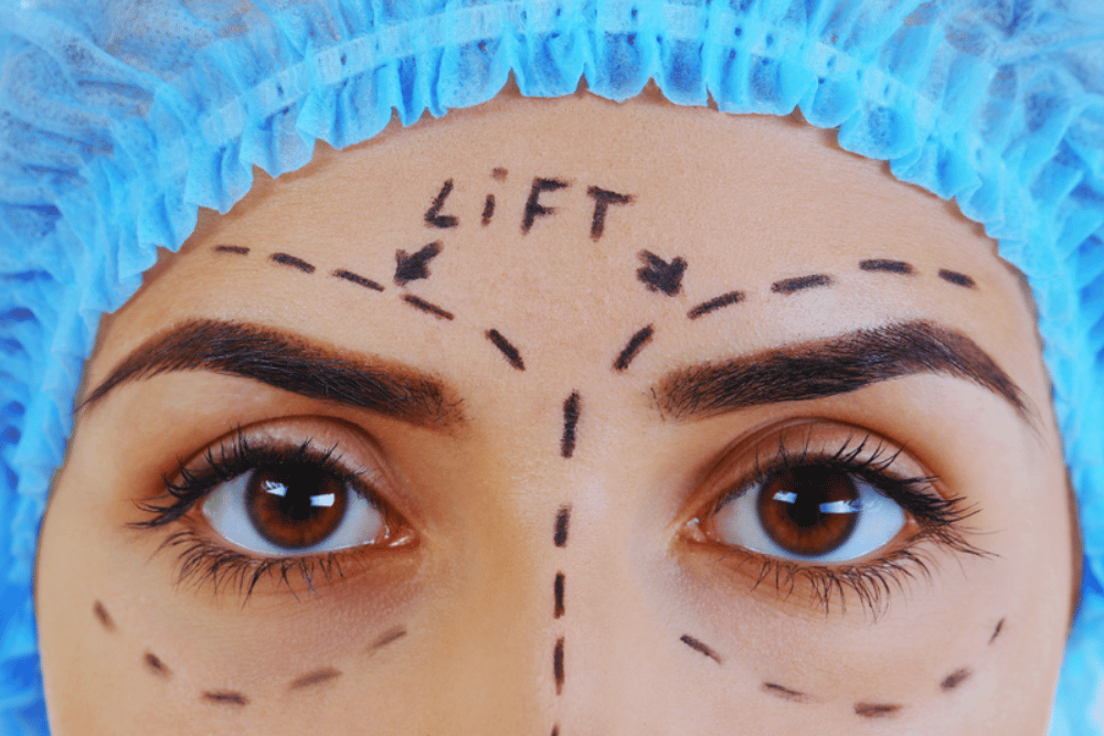 Eyelid surgeon in Virginia