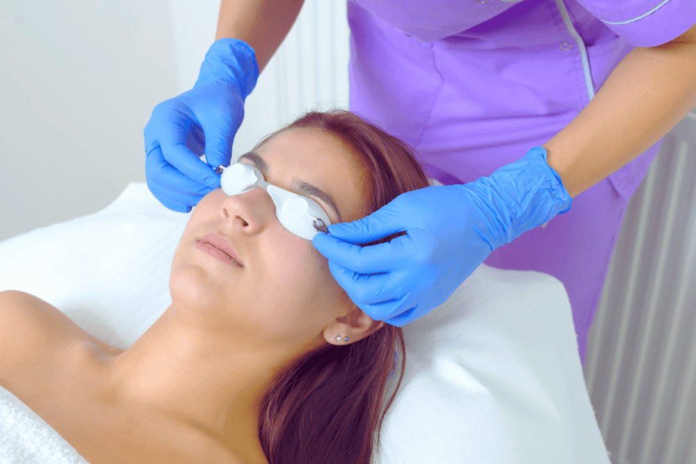 Laser skin resurfacing in Fairfax VA