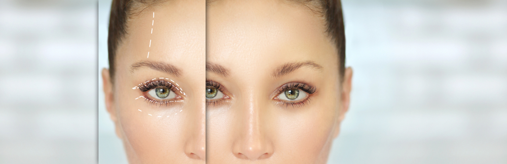 Revision Eyelid Surgery Pricing in Northern Virginia: What to Expect