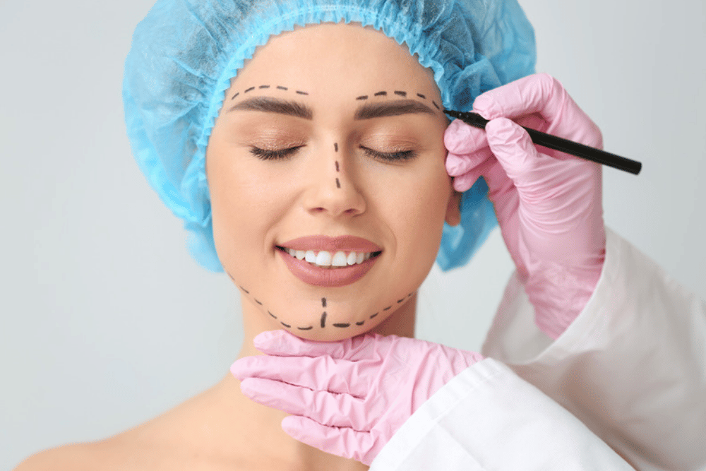 Facelift Surgery in McLean VA
