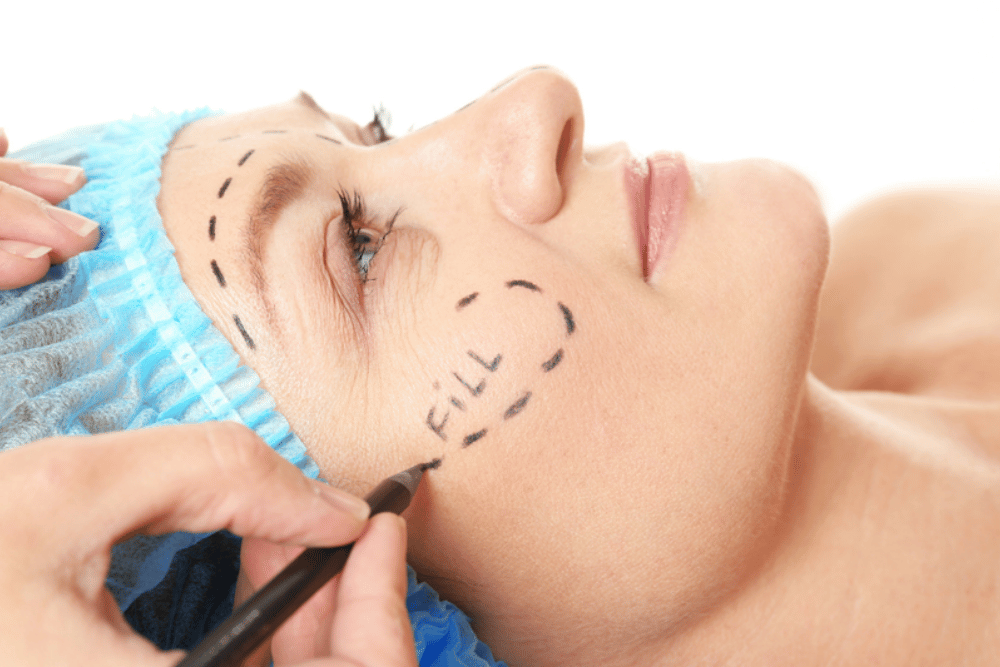 Upper Eyelid Surgery in Vienna VA